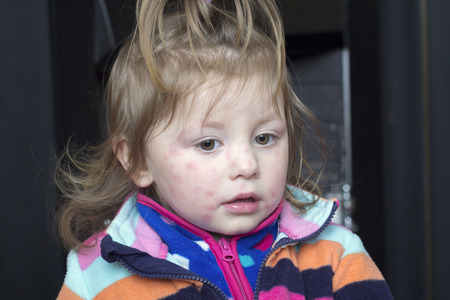 עורך דין נזקי גוף, בת 3 אכלה וופל ופונתה לבי״ח – עיריית ראשל״צ תפצה על התרשלות הגן