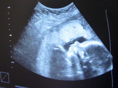 עורך דין רשלנות רפואית, 