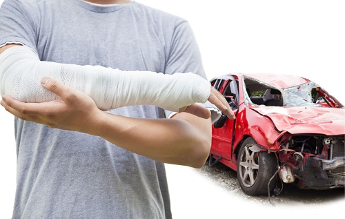 עורך דין תאונת דרכים, חברות הביטוח טענו שהתאונות קלות אבל הנפגע יפוצה ביותר ממיליון ש'