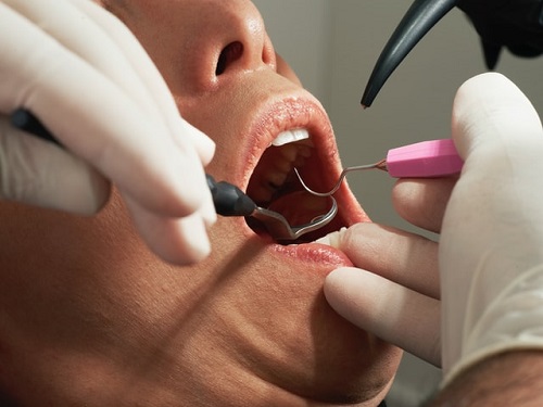 עו"ד רשלנות רפואית, מרפאת שיניים הפסיקה טיפול בגלל חוב – המטופל יפוצה ב-97 אלף ש'